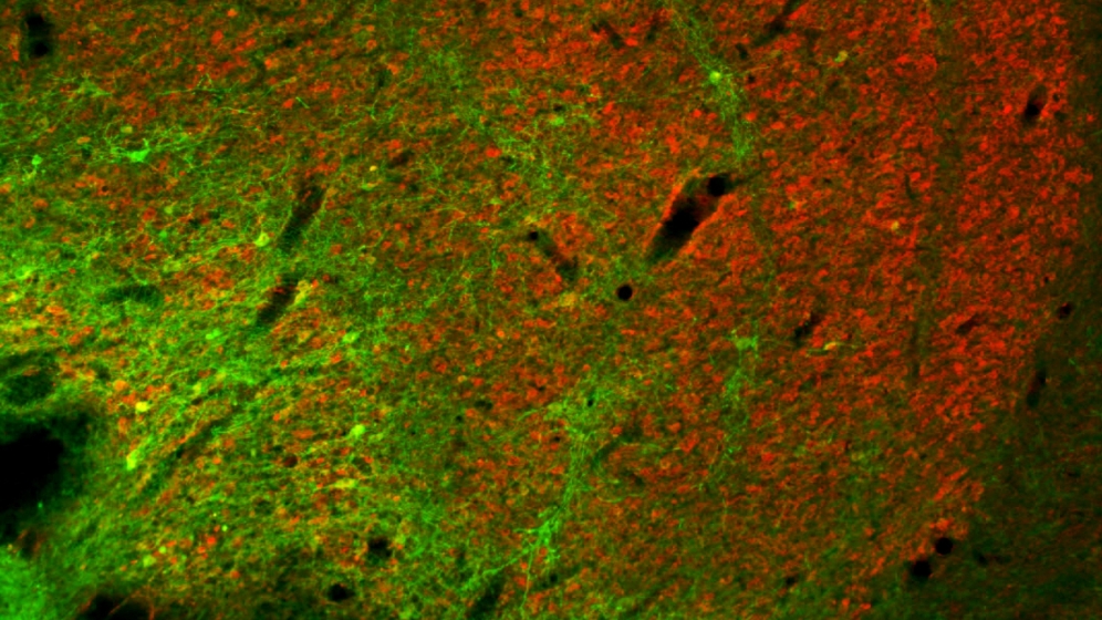 Angefärbte Koniozellen