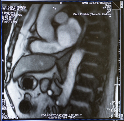 Standbild aus dem Echtzeit-MRT