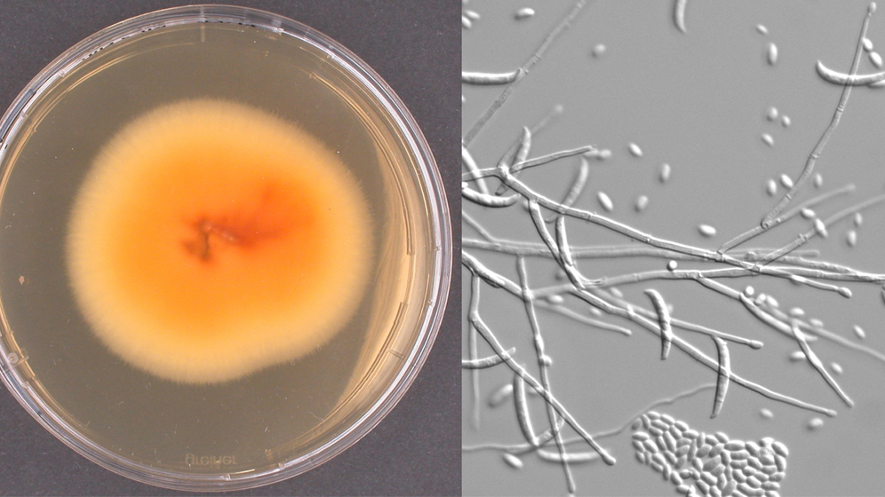 Kultur_und_mikroskopische_Aufnahme_Fusarium_spp_NRZ_Myk_HKI.jpg Fusarium spp.