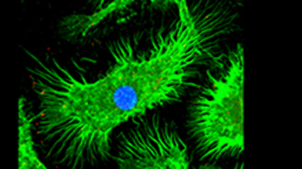 Thrombo-Inflammation