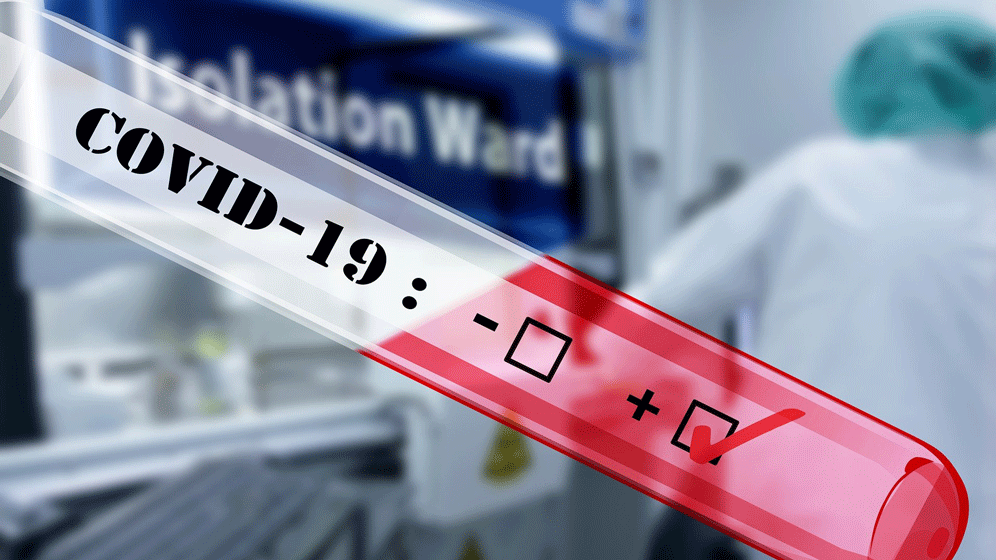 covid-19-4908692_1920.gif Labortests