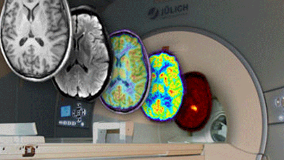 2018-03-16-human_brain.gif Hirnforschung