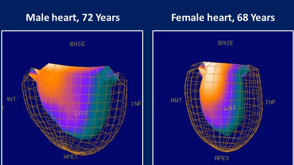 Herz_Vergleich.gif Herz