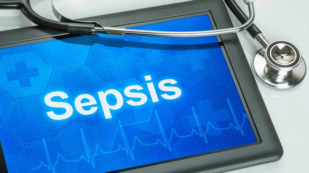 Sepsis