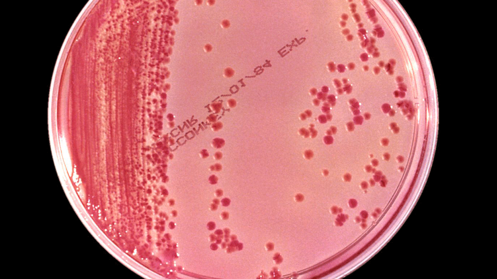 Antibiotikaresistenz