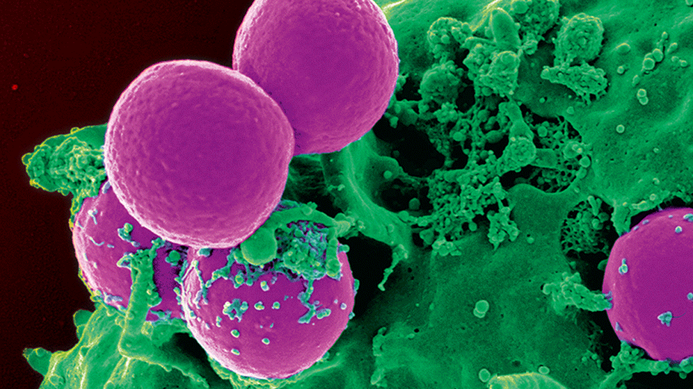 Multiresistente Erreger