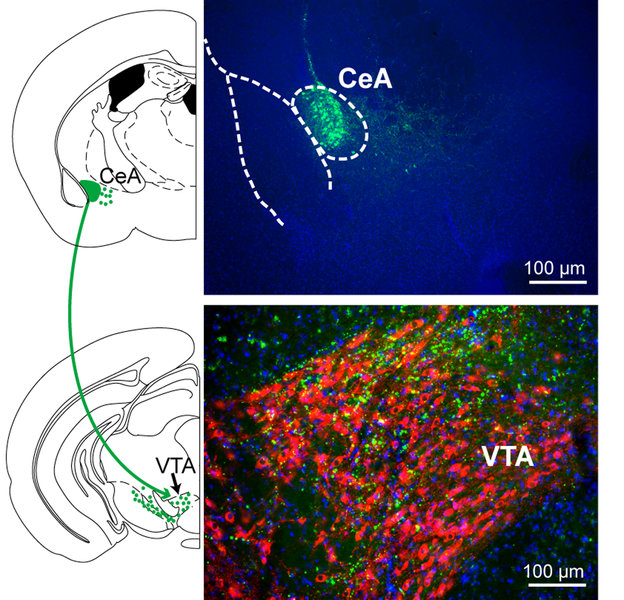 CRH Neuronen des zentralen Mandelkerns 