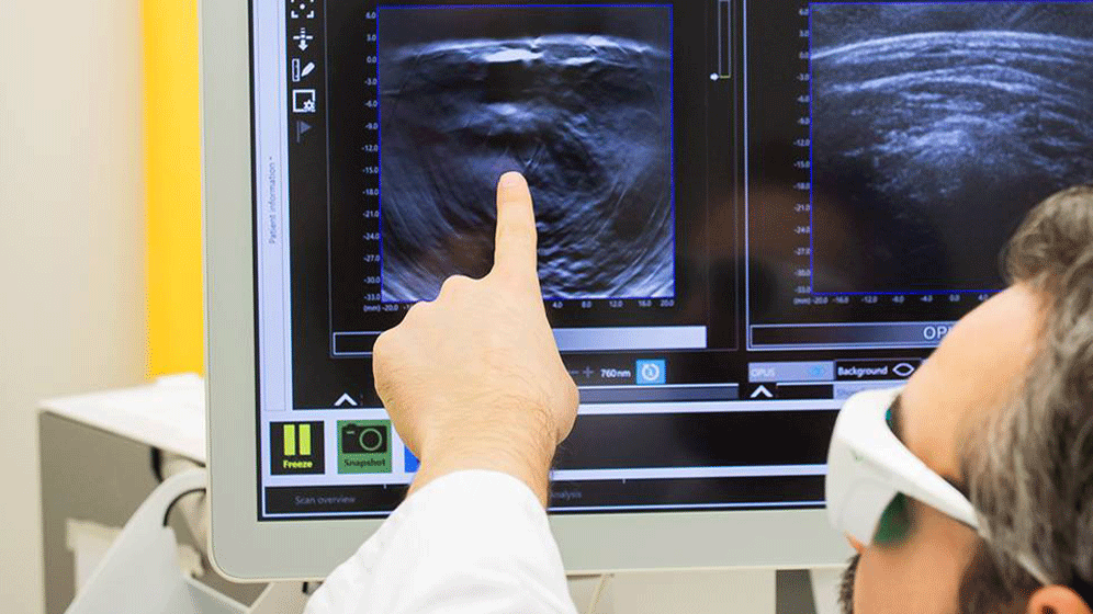 csm_200526_PI_Optoakustik_Brustkrebs_31497fe5d7.gif Optoakustische Mesoskopie