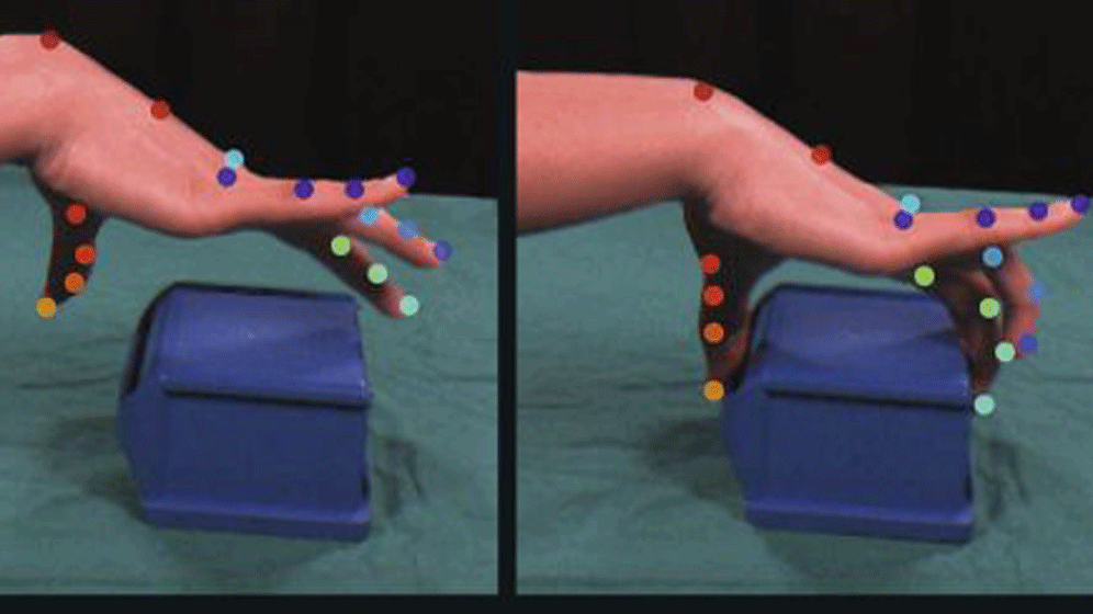 Handbewegung_DeepMovementDiagnostics.gif Deep Movement Diagnostics