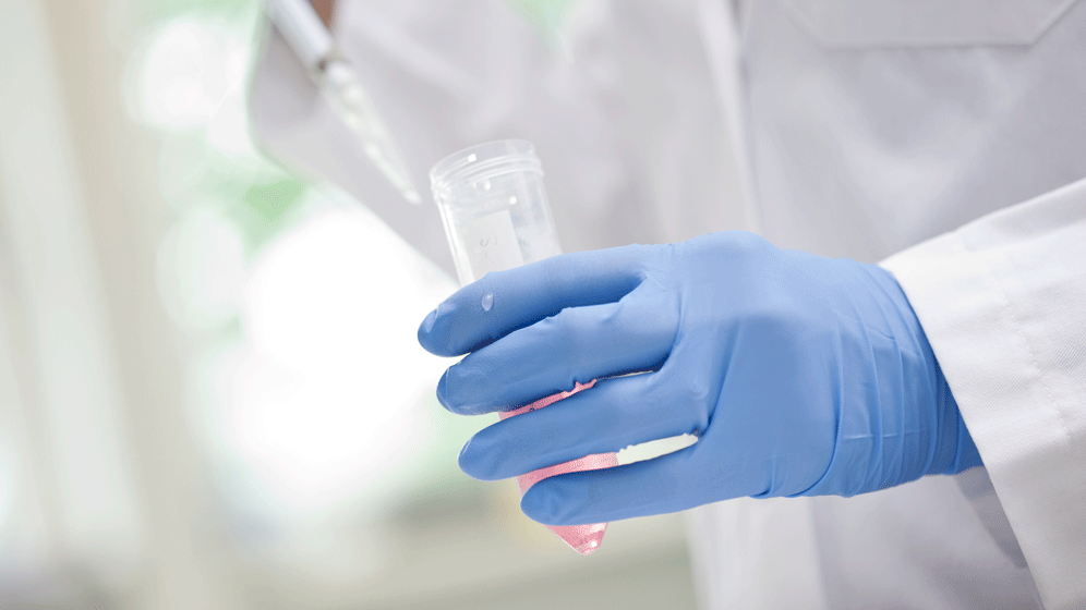 UKF_Labor-1_02.gif klebsiella pneumoniae