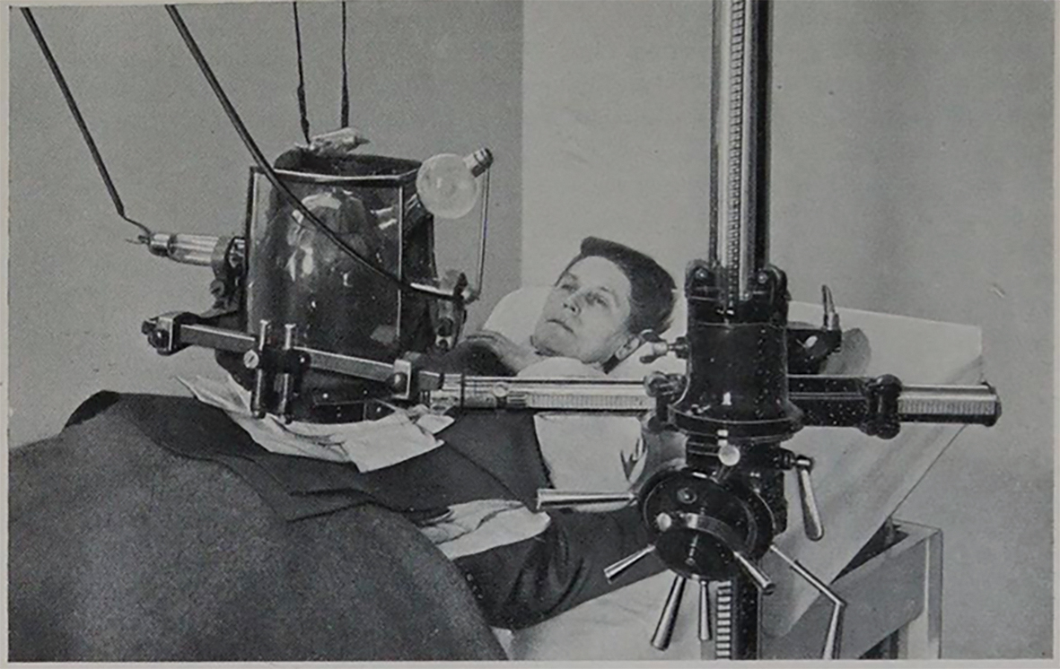 Historisches Foto einer gynäkologischen Bestrahlung