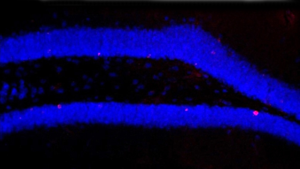 Hippocampus nach Behandlung 