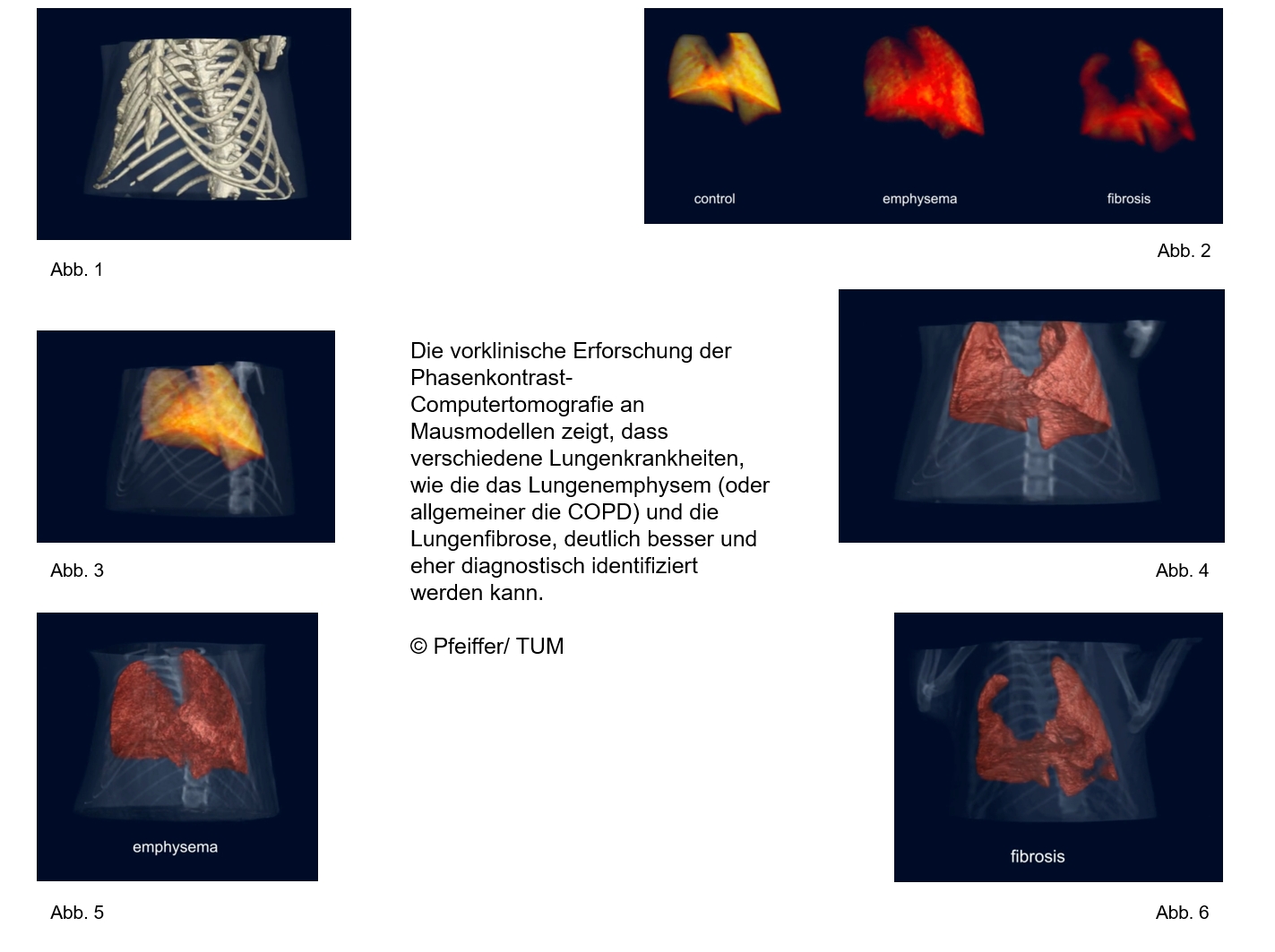 Phasenkontrast-Bildgebung