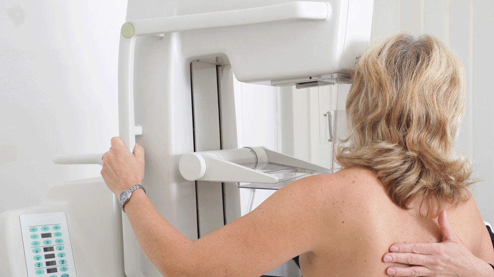 Mammographie-Screening