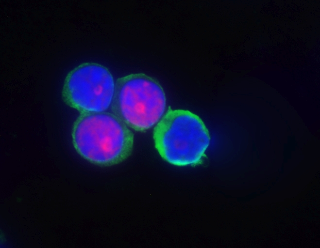 Immungefärbte humane T-Lymphozyten 