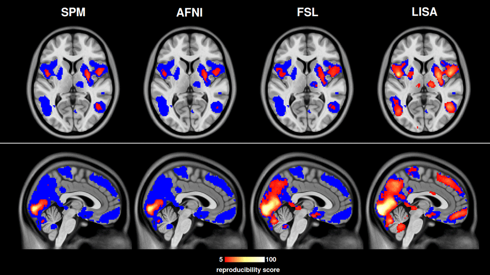 newsimage307231.gif fMRT