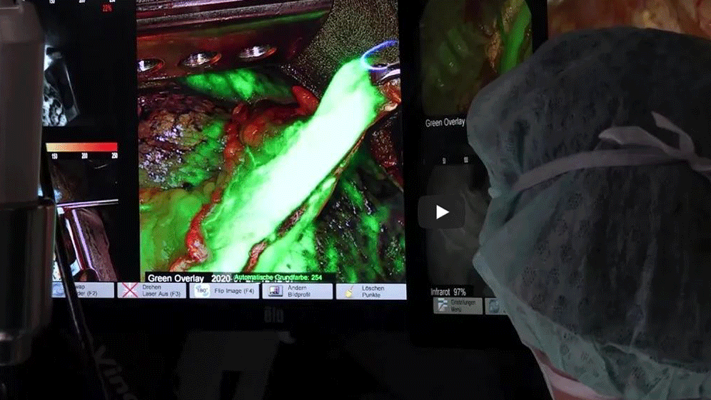 Leipzig.gif MIC-Turm