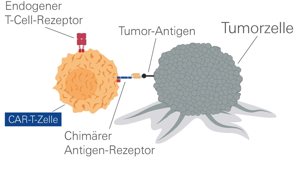 Multiples Myelom