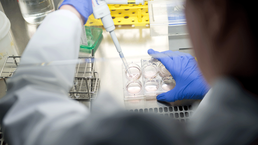 newsimage312992.gif CAR-T-Zelltherapie