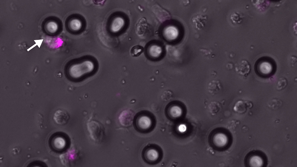 newsimage334067.gif Natürliche Killerzellen