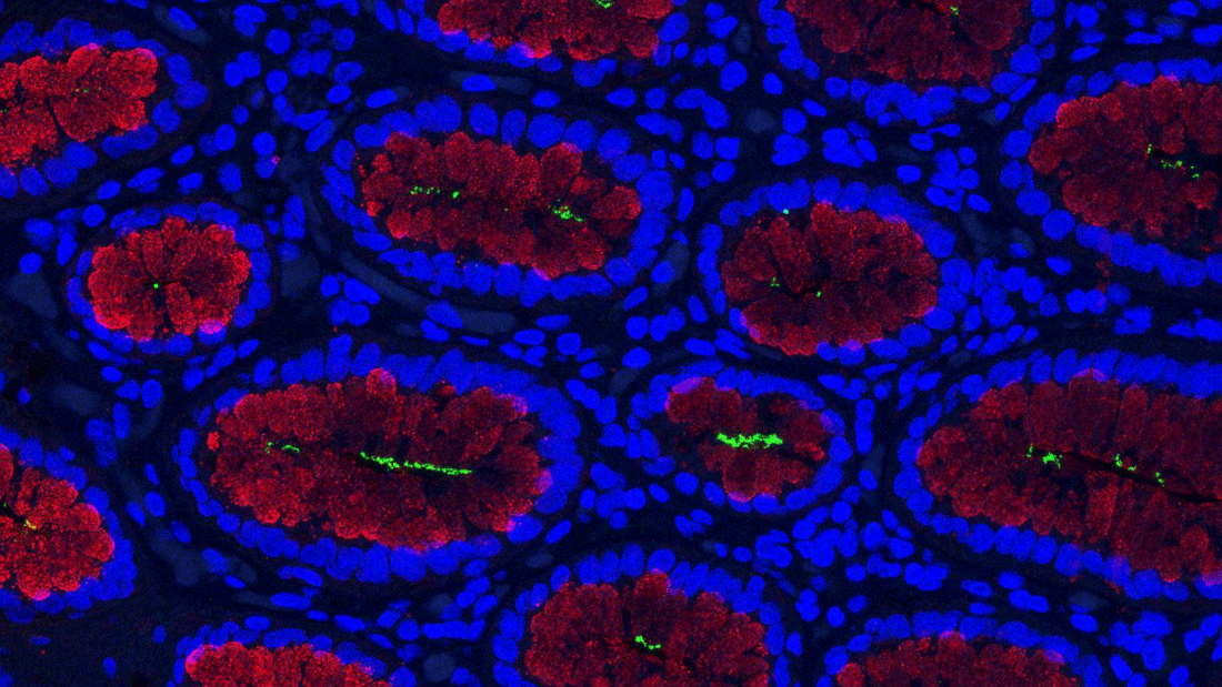 Das Bild zeigt eine mikroskopische Aufnahme eines Gewebeschnitts von einem menschlichen Magen mit Helicobacter pylori-Infektion. Blau markiert die Zellkerne, Rot markiert den Schleim, der in den Grübchenzellen gebildet wird, Grün markiert Helicobacter pylori.