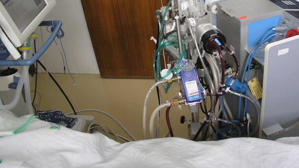 ECMO-Gerät