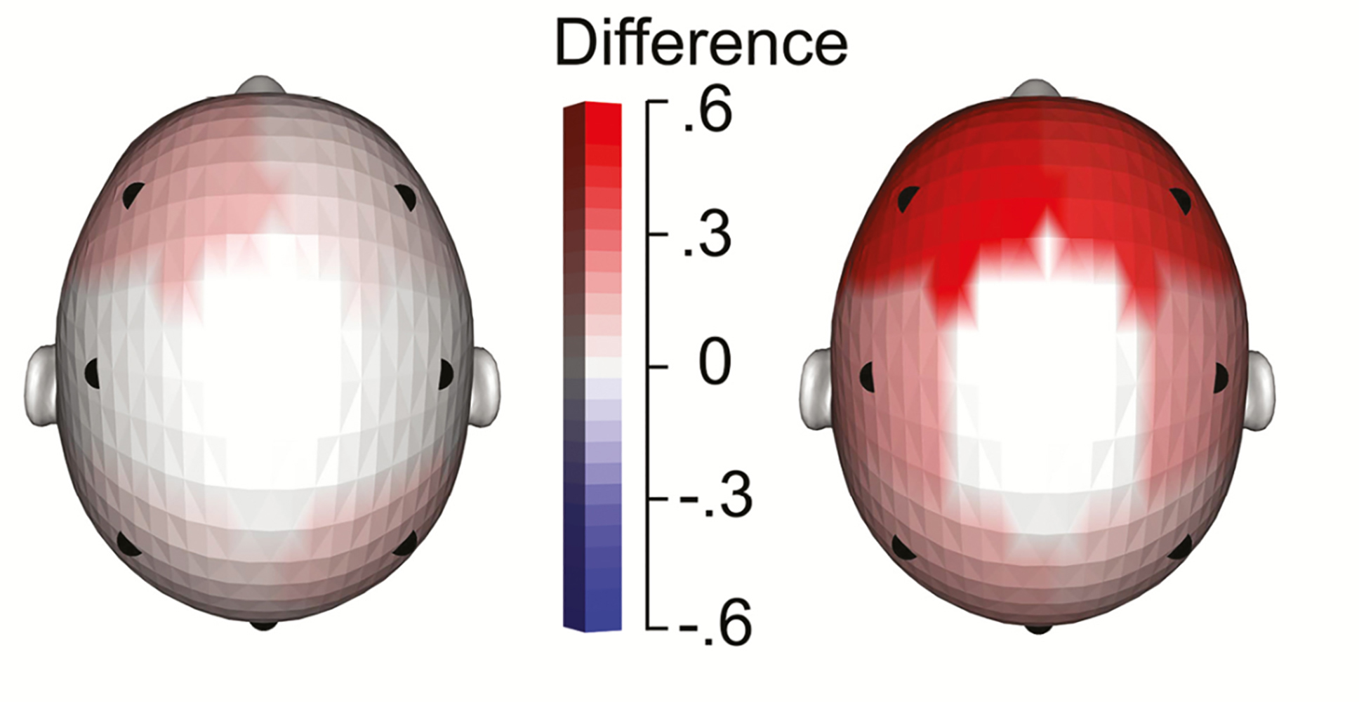 Gesamt-Hirnaktivität