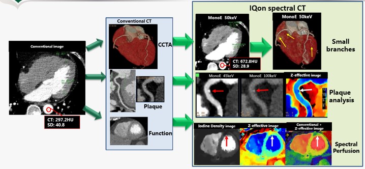 Übersicht Cardio-CT IQon