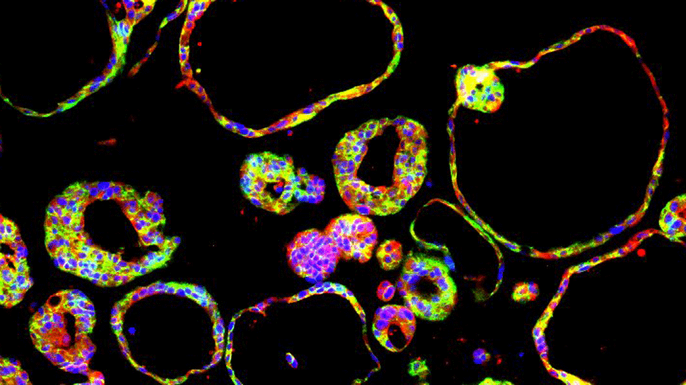 Duktale Pankreas-Organoide