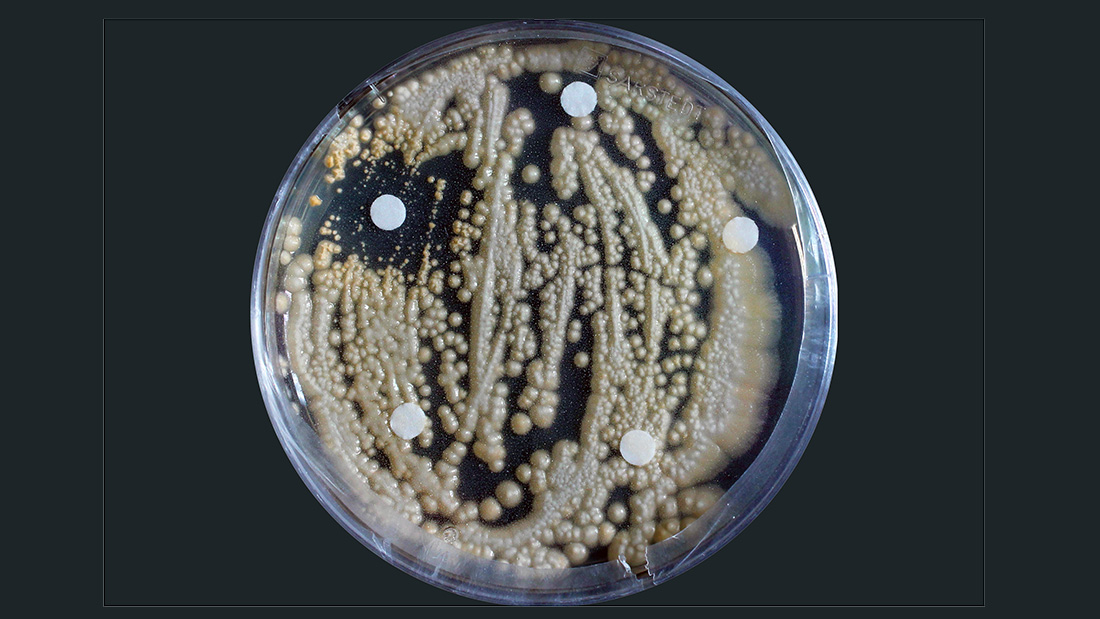 Pilz_Apiotrichum-porosum.jpg Petrischale vor schwarzem Hintergrund mit Ausstrichen eines Pilzes