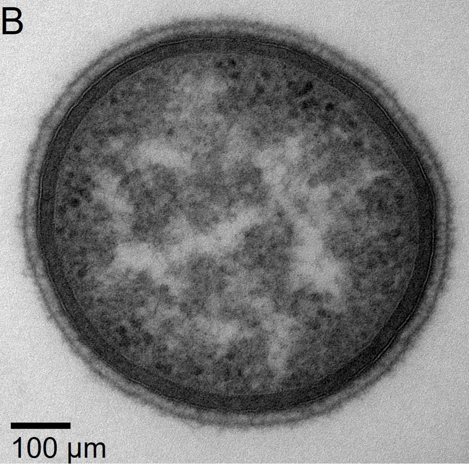 Querschnitt.jpg neu entdeckten Bakterien