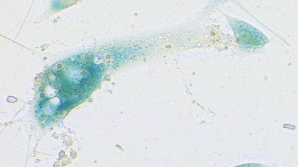 Seneszente_SARS-CoV-2-infizierte_Schleimhautzellen.gif Seneszenz