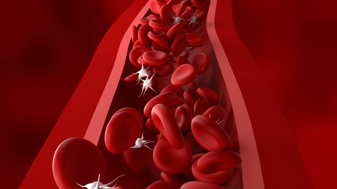 Symbolbild für Immunthrombozytopenie