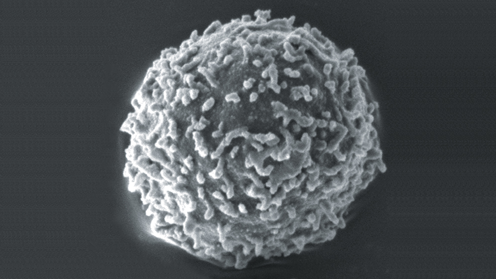 Lymphozyten Hämatologie