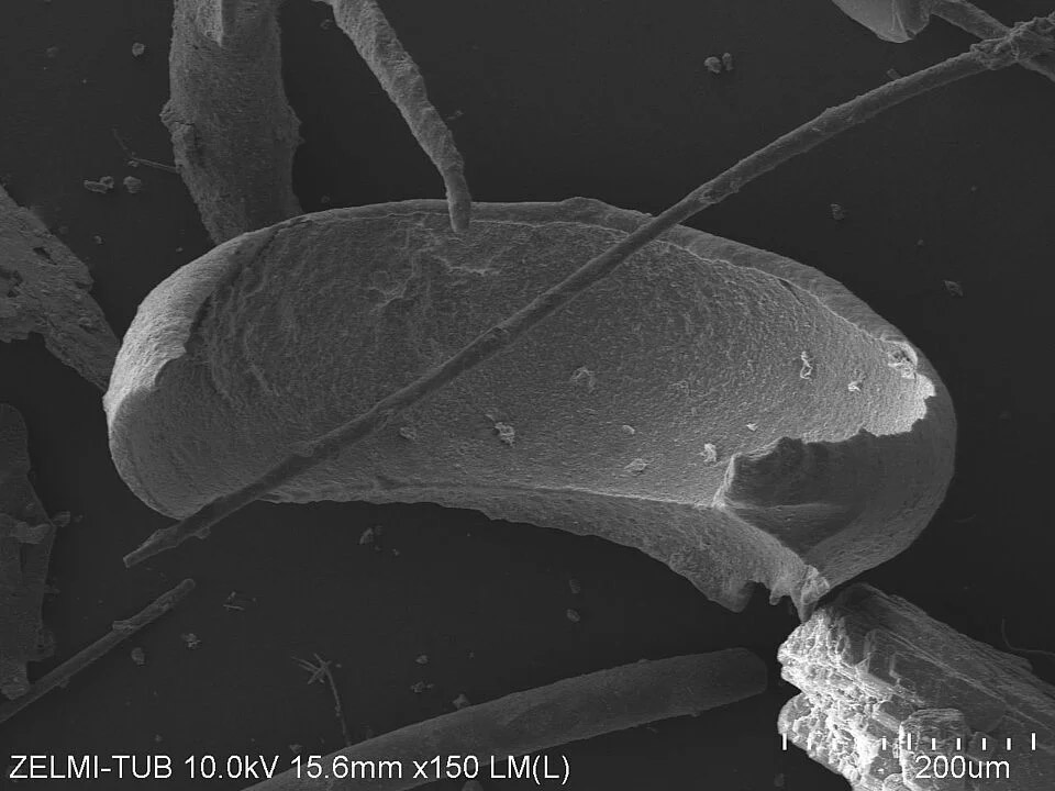 Bisher unbekannte Mikrorganismen