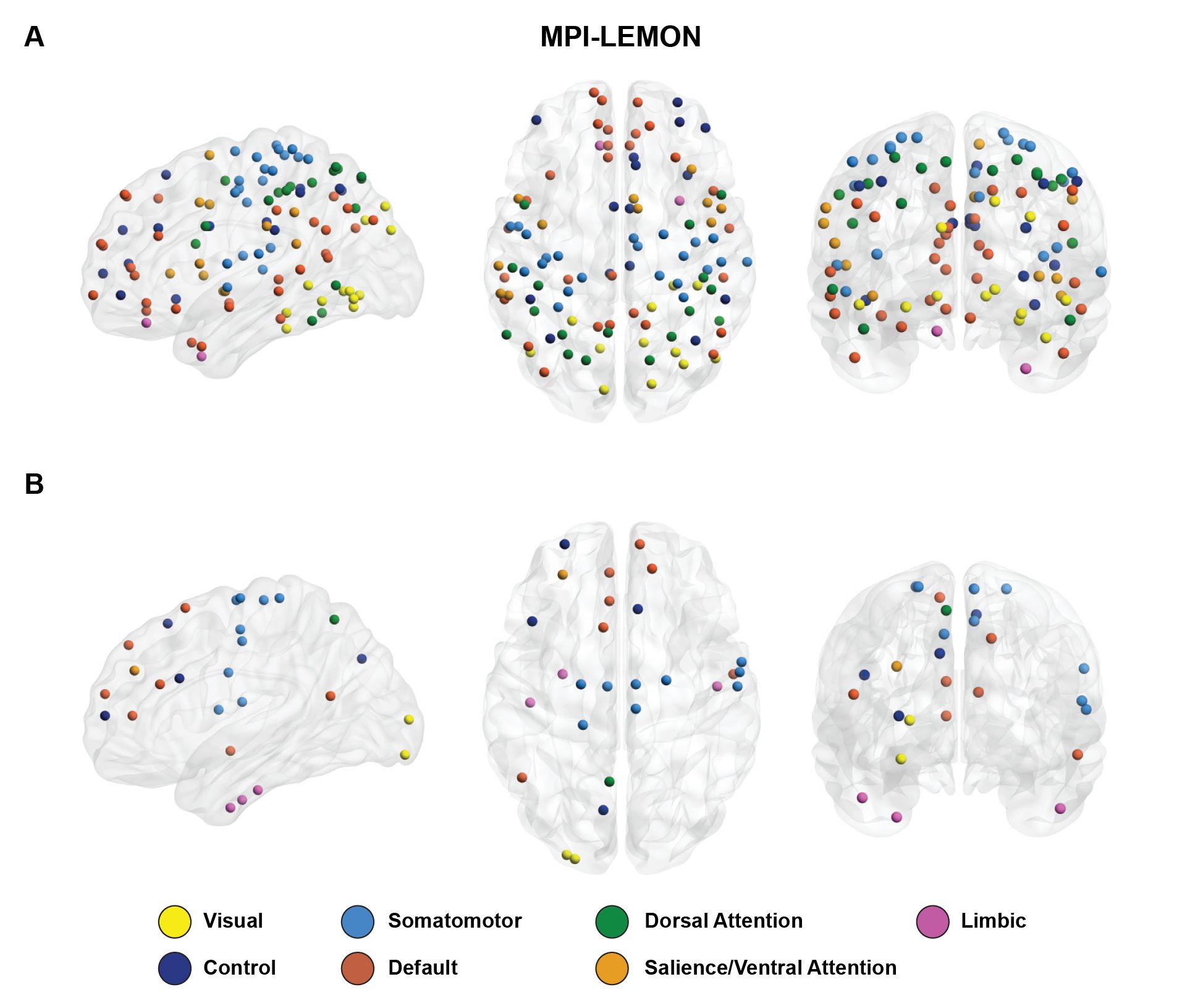 Visuelle Darstellung von Hirnregionen mit signifikanten Unterschieden in der Knotenpersistenz zwischen den Gruppen.