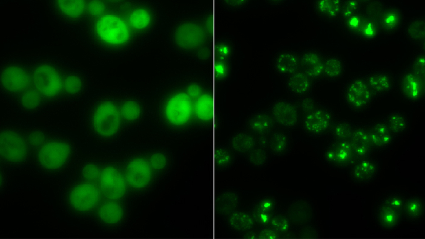 Bei Stress verklumpen Proteine bild2csm_Hefezellen_Gruppe_Prof_Matthias_Peter_ETH_Zürich_1b9022a8db.jpg