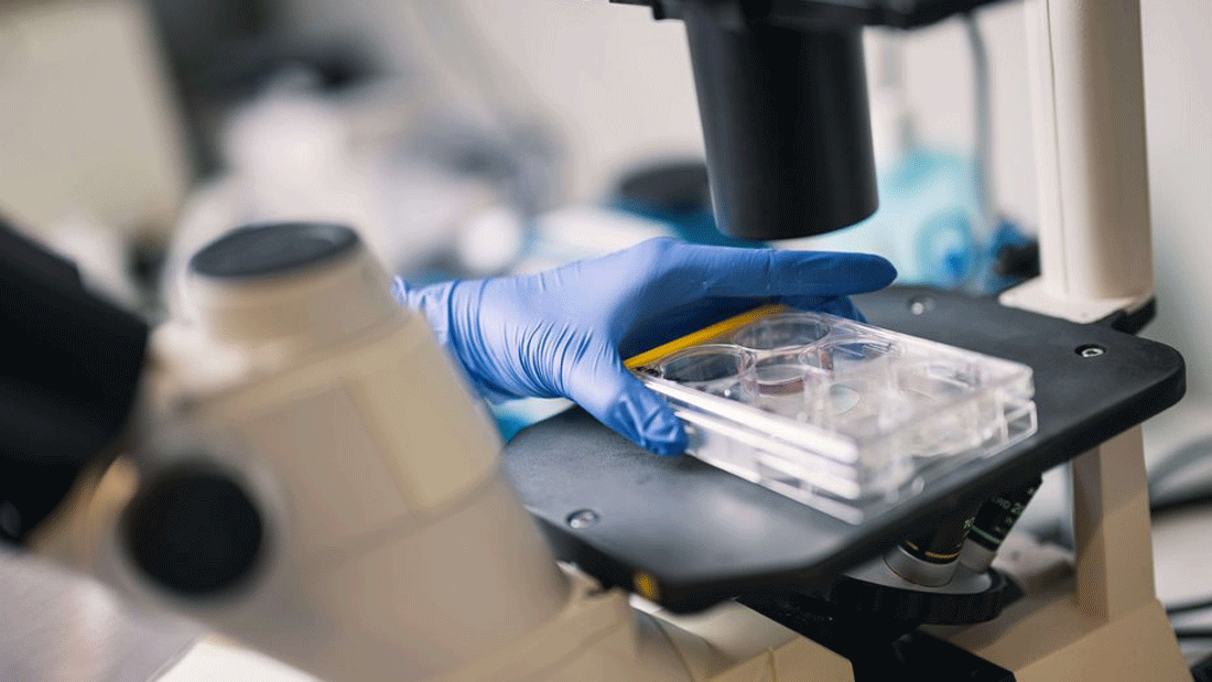 Dieses Bild zeigt eine Laborsituation, in der eine behandschuhte Hand eine Multi-Well-Platte auf dem Mikroskoptisch platziert.