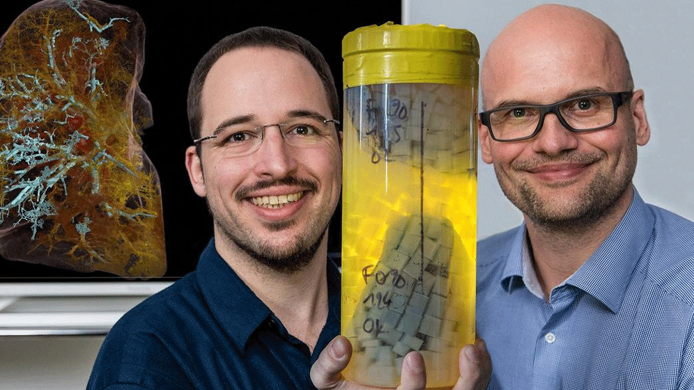 COVID-19: Veränderungen in der Lunge