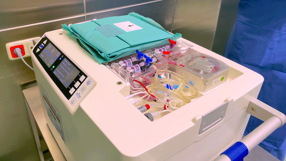 Die geöffnete „Heart Box“ newsimage396394.gif