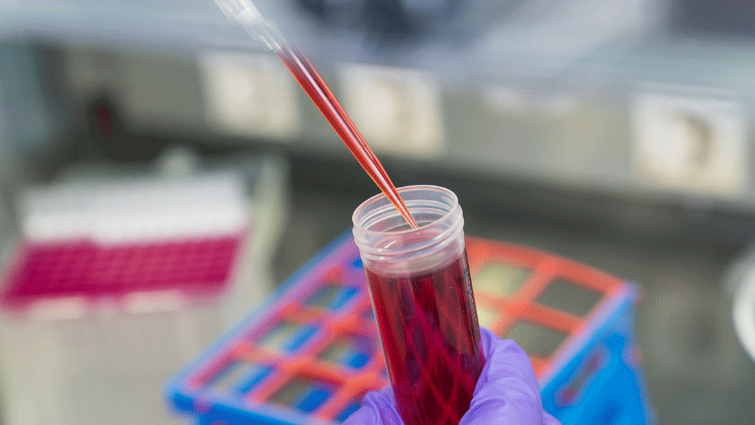 Für das neue, nicht invasive Diagnostikverfahren wird zellfreie DNA aus dem Blut von Patienten isoliert.