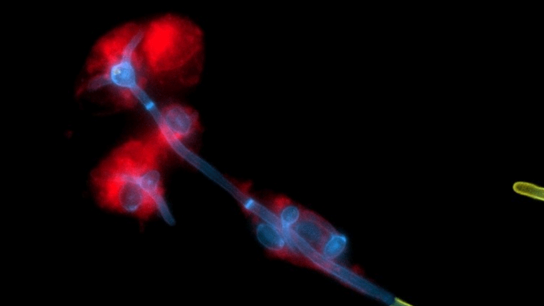 Durch die Bildung von langen fadenähnlichen Zellen, den Hyphen, bricht der Hefepilz Candida albicans (blau) aus menschlichen Immunzellen (rot) aus. Der Teil der Hyphe, der die Immunzellen bereits verlassen hat, ist gelb eingefärbt.