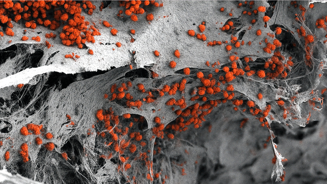 Rasterelektronenmikroskopische Aufnahme des künstlich hergestellten 3D-Knochenmarkgewebes, das mit menschlichen Blutzellen (rot) besiedelt ist.