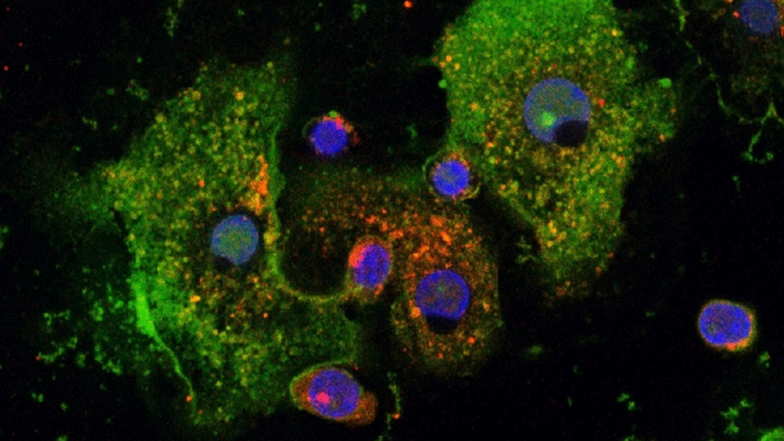 Humane Makrophagen mit immunregulierendem Peptid Pep19-2.5 (grün) und Färbung der „dispersed Transgolgi Netzwerk Membran“ (rot).