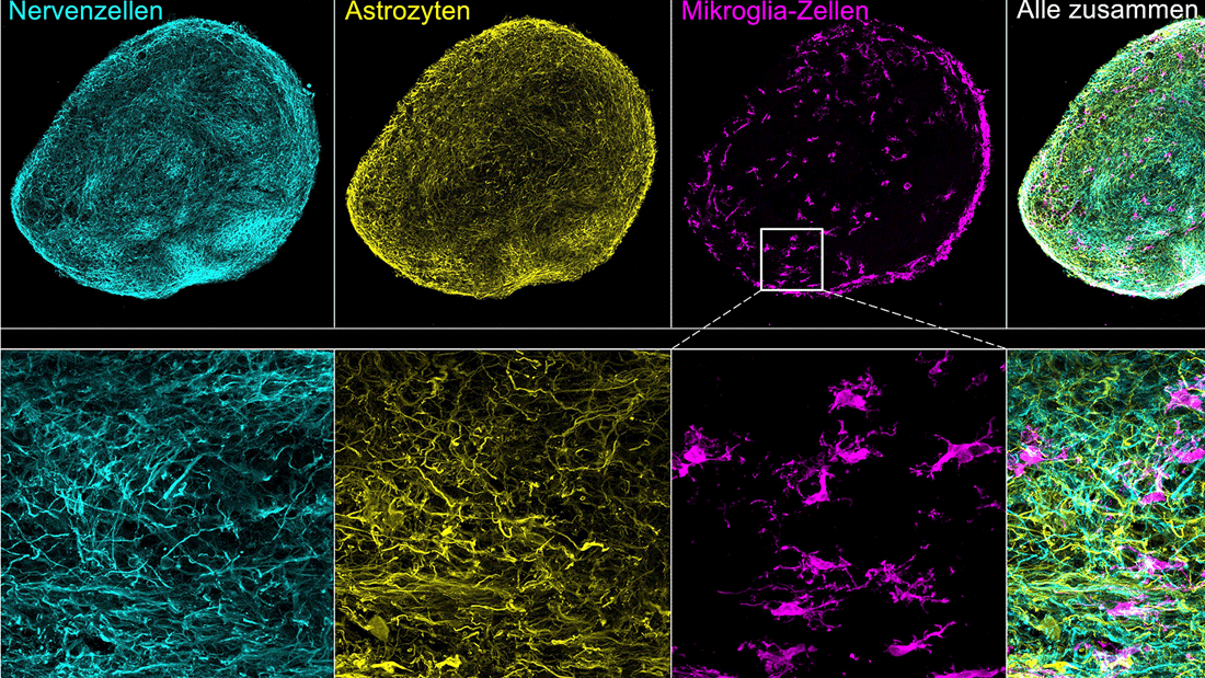 Mikroskopische Ansicht eines 3D-Hirngewebemodells, in dem die verschiedenen Zelltypen angefärbt sind (Nervenzellen: türkis; Astrozyten: gelb; Mikrogliazelle: pink). Die typische Morphologien der verschiedenen Gehirnzelltypen sind gut erkennbar.