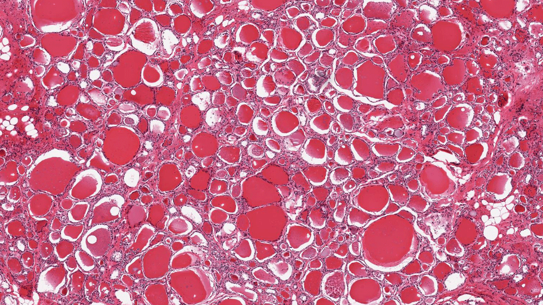 Histologischer Schnitt einer Schilddrüsengewebeprobe aus dem GTEx-Portal