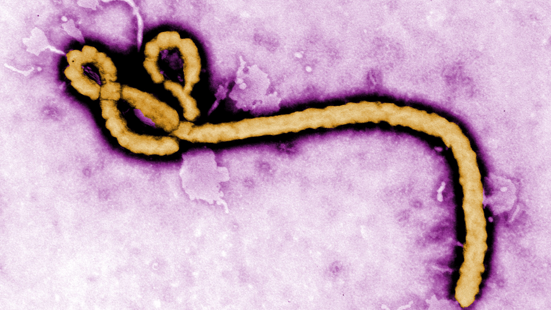 Kolorierte Transmissionselektronenmikroskopaufnahme eines Ebola-Viruspartikels
