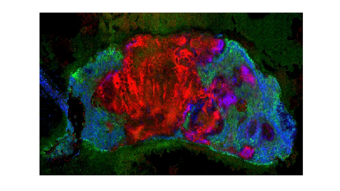 Der Querschnitt zeigt die räumliche Verteilung verschiedener Lipide im Darmgewebe, sichtbar gemacht mit bildgebender Massenspektrometrie (Mass Spectrometry Imaging, MSI). Ceramide sind in Grün zu sehen.