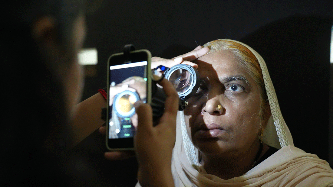 Smartphone-basierte Netzhautbildgebung im Einsatz in Indien: Die Aufnahme entstand im Rahmen eines Kooperationsprojekts des UKB mit der Sankara Eye Foundation India zum Smartphone-basierten telemedizinischen Screening auf diabetische Retinopathie.