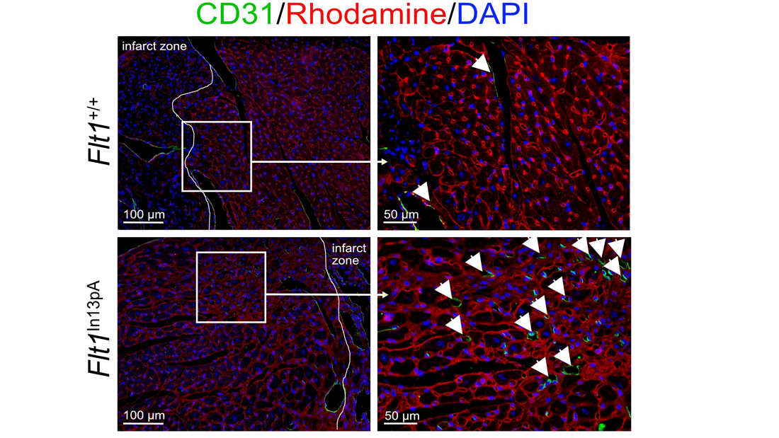 Immunfluoreszenzfärbung von CD31-positiven Kapillaren und Rhodamin-Färbung zur Abgrenzung der Kardiomyozyten im infarktgeschädigten Myokard (28 Tage nach Infarkt). Im genetisch veränderten Mausmodell (unten) sind mehr Kapillaren als in Wildtyp-Mäusen.